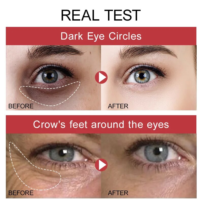 Peptide Eye Cream Dark Circles Remover Eye Bags Anti-Wrinkle Firmness Whitening Under Eyes Serum Beauty Health Skin Care Product